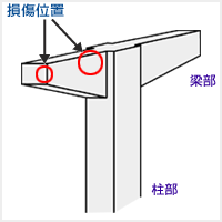 損傷位置イラスト